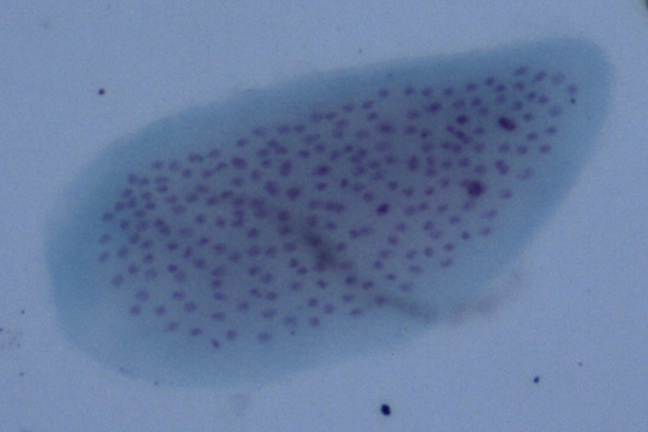 Opalina ranarum